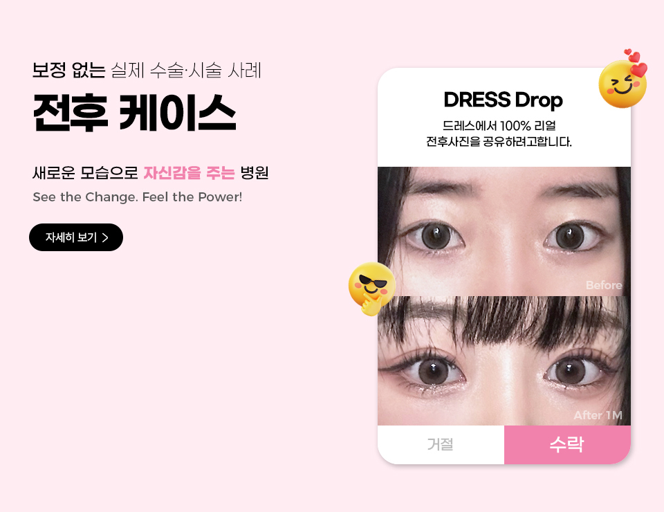 Dress Phẫu thuật thẩm mỹ - 사진 2